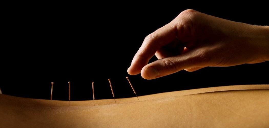 Traditional Chinese Acupuncture